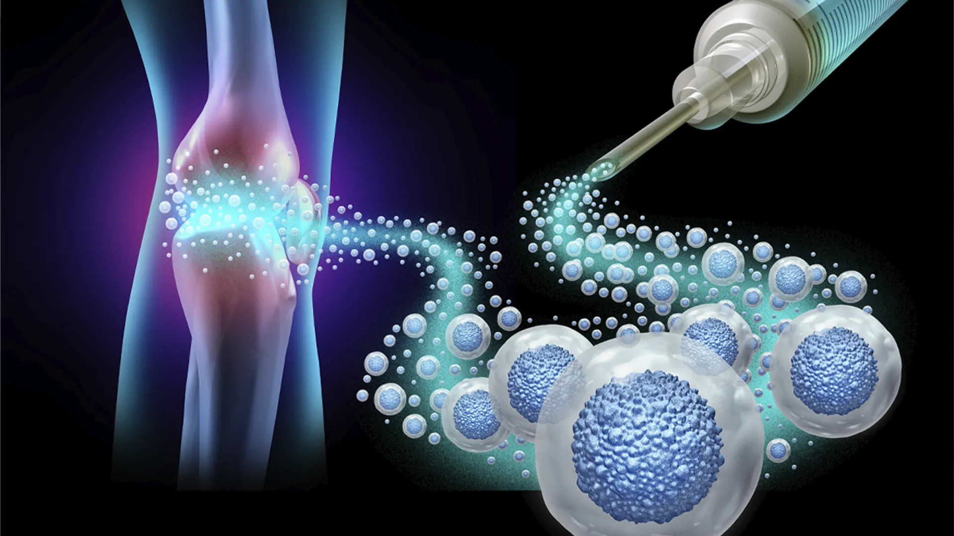 Medicina Regenerativa: el nuevo paradigma en el tratamiento de la artrosis, el dolor articular y las lesiones musculoesqueléticas.